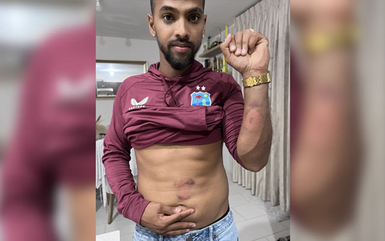 Nicholas Pooran