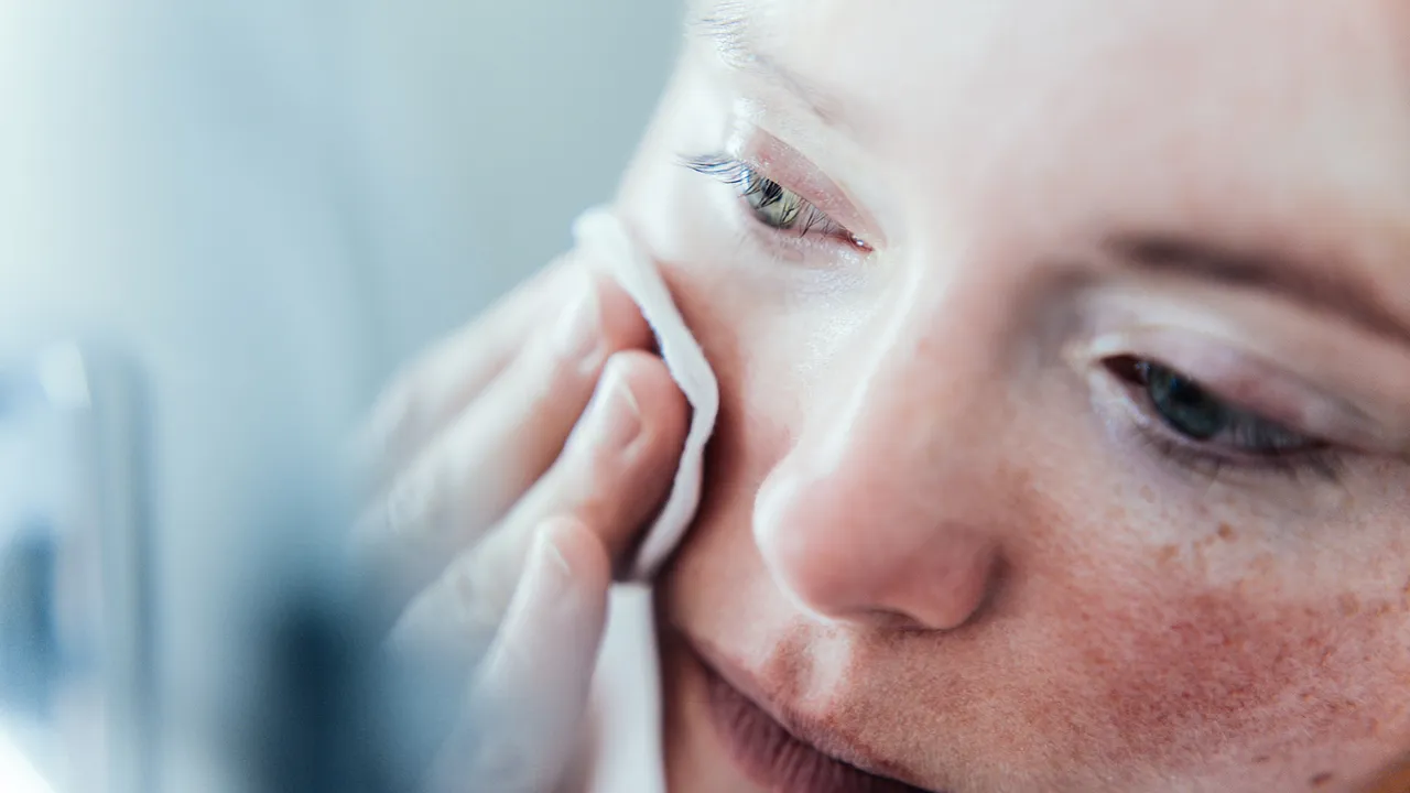 Acne.jpg