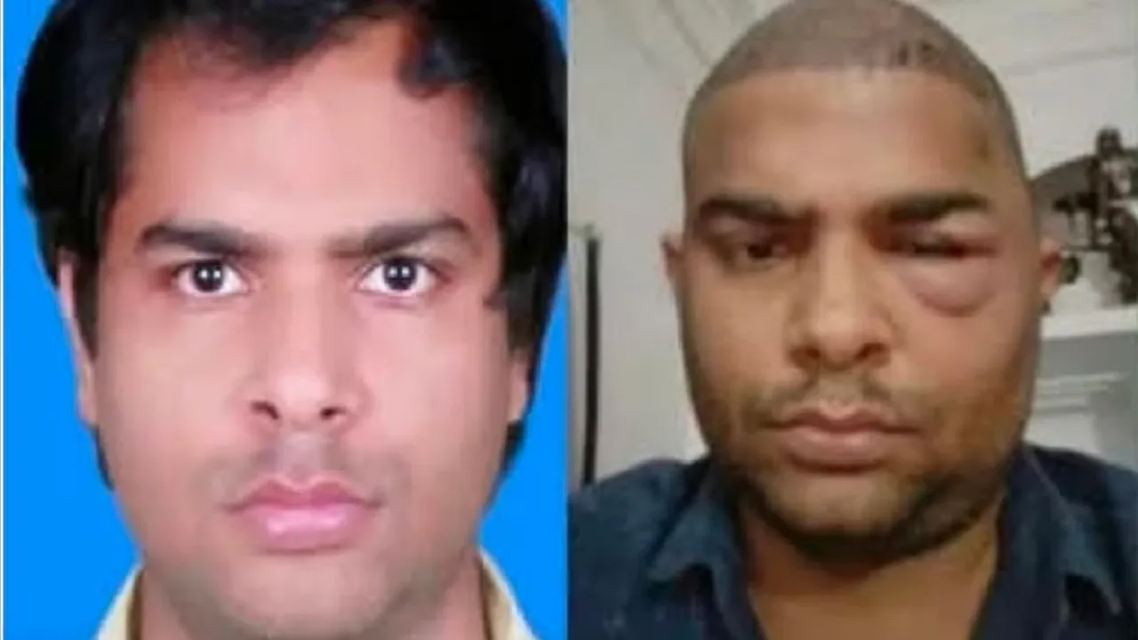 Kanpur Hair Transplant Death