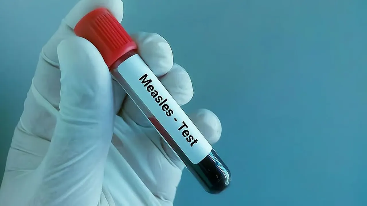 Senapati Measles Outbreak Manipur
