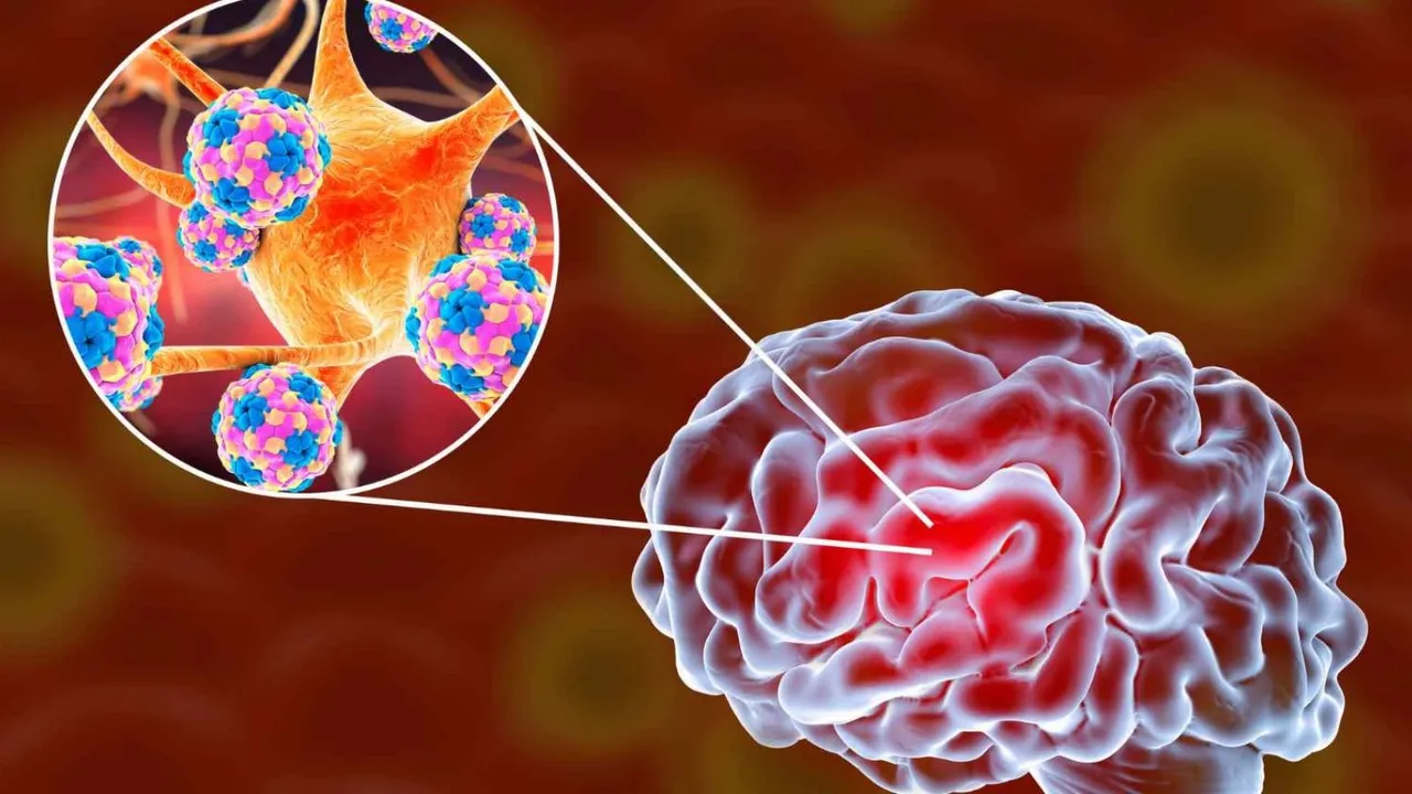 Kerala Amoebic Encephalitis Amoeba