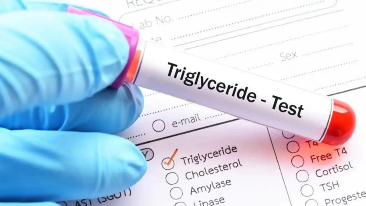 High Triglycerides Cholesterol