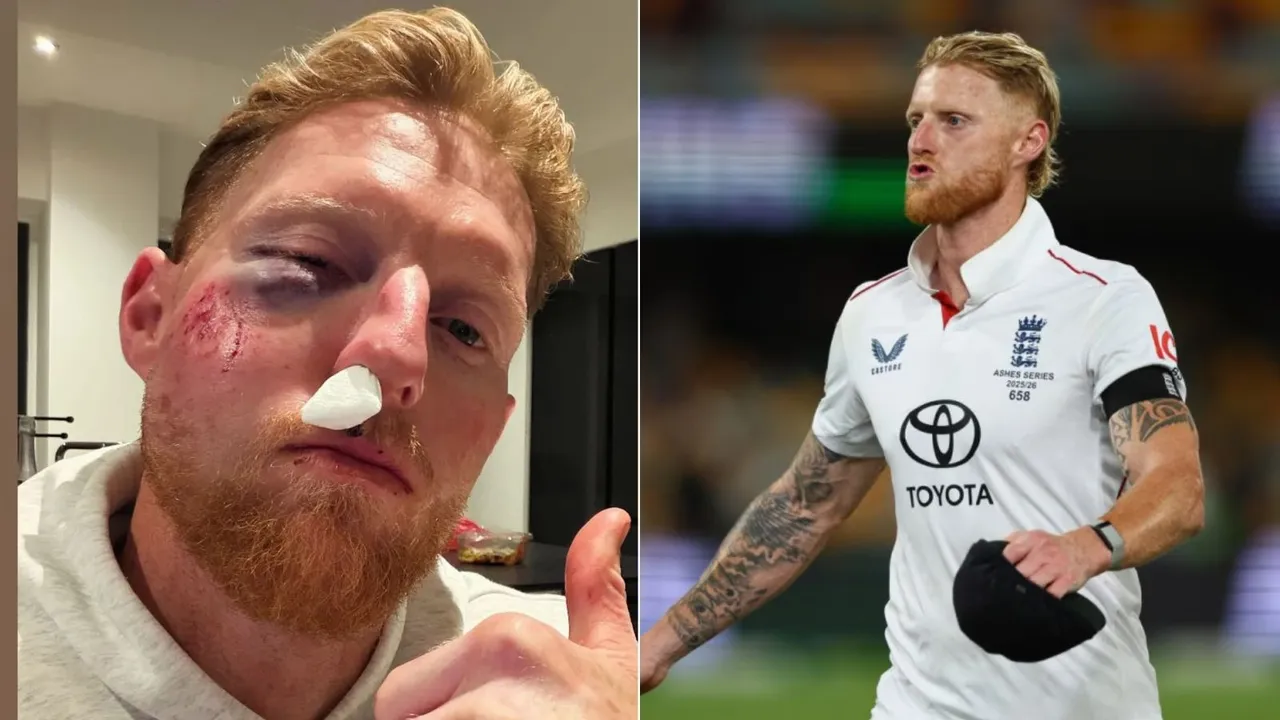 Ben Stokes Injury