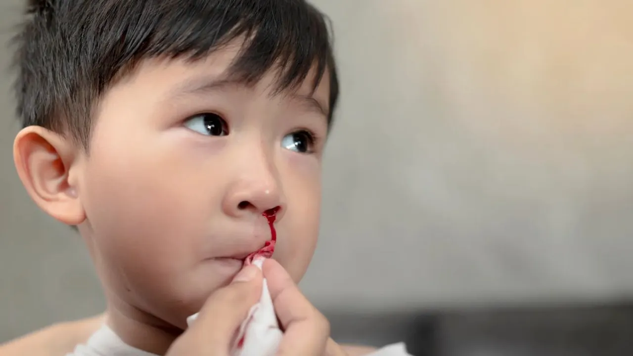nosebleeding Blood