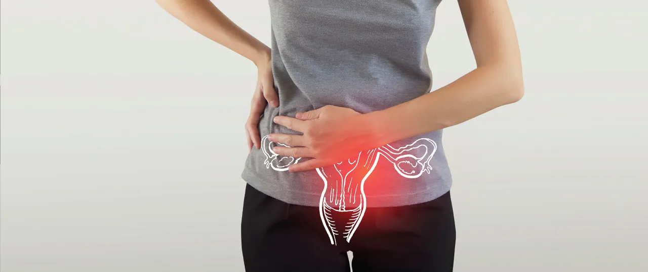 Polycystic ovary syndrome PCOS.jpg