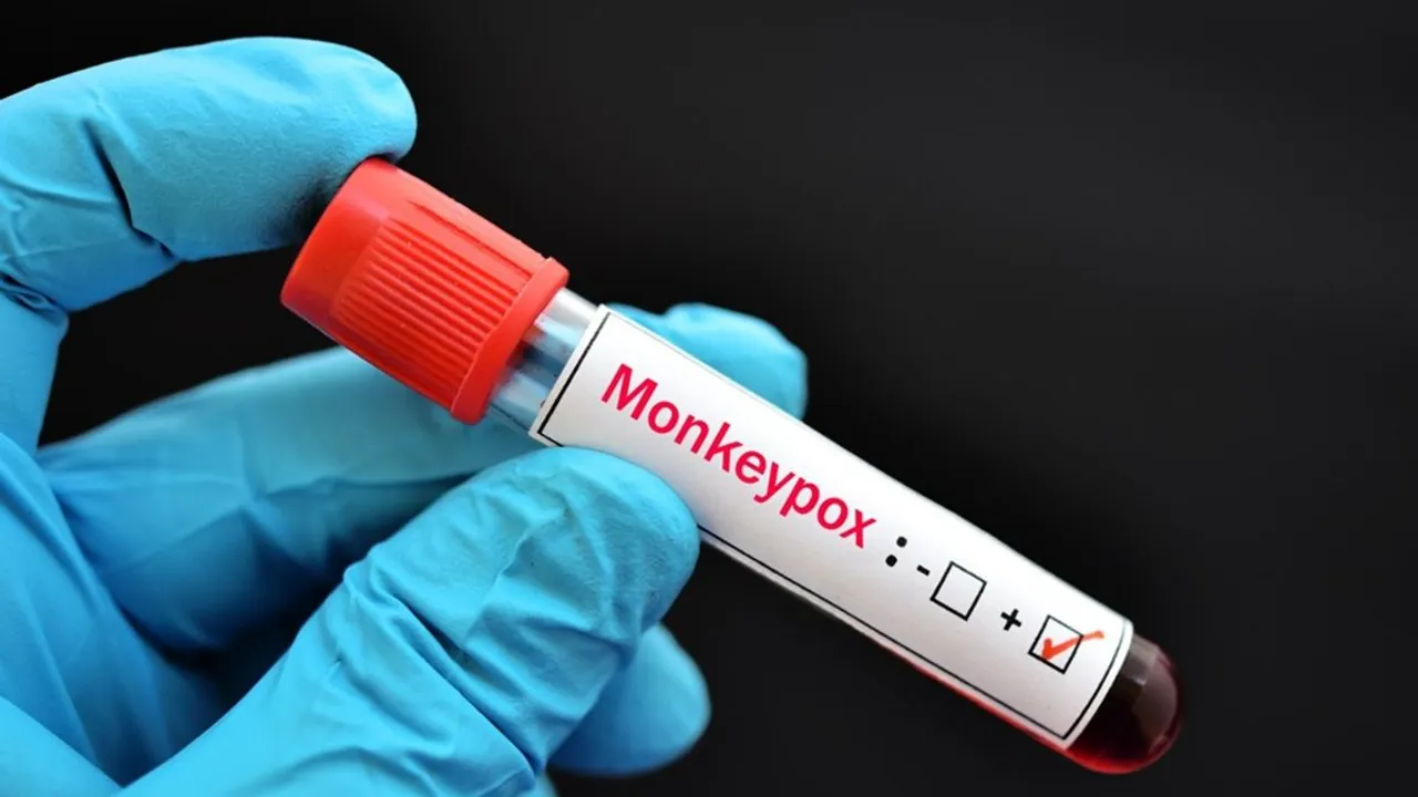 monkeypox MPox