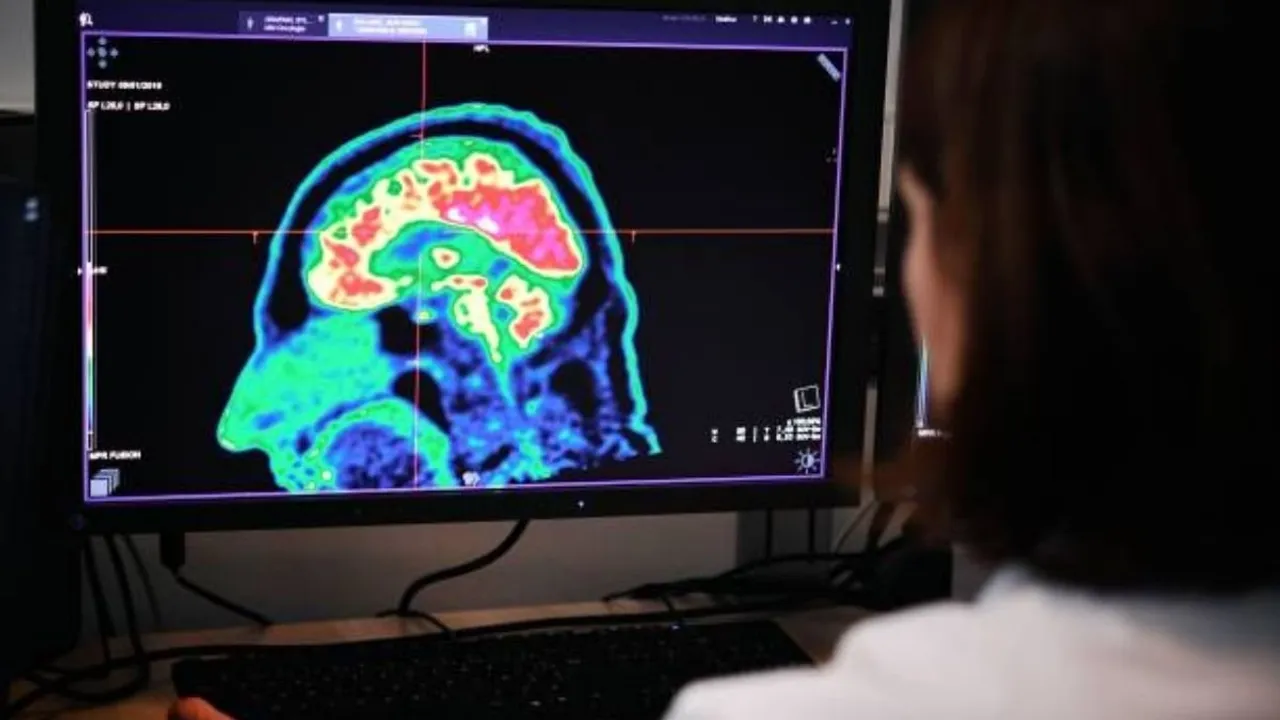 Brain Tumour