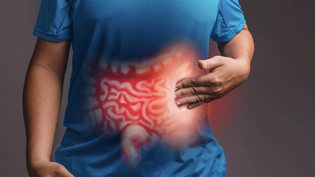 Inflammatory bowel disease.jpg