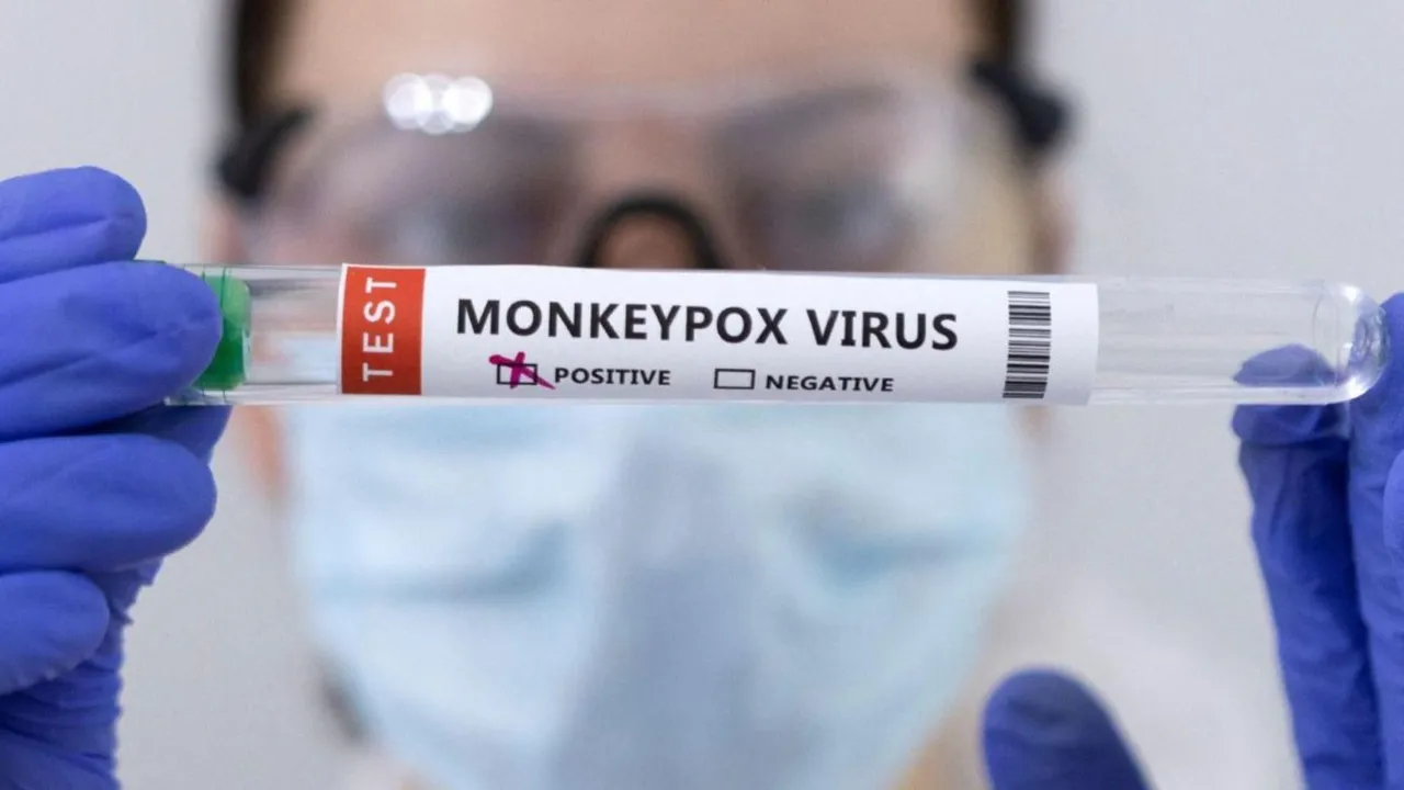 Monkeypox