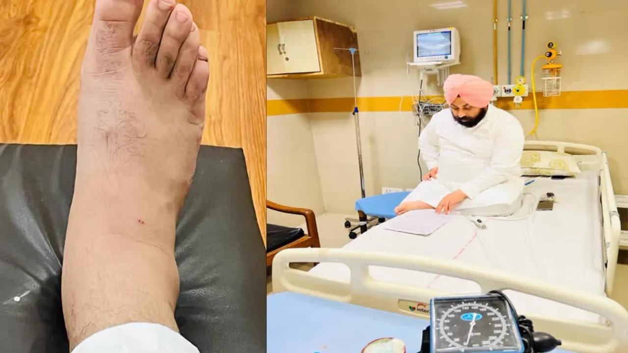 Harjot Bains Snake bite