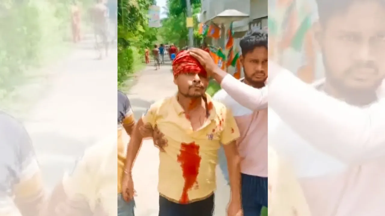An injured being taken for treatment after violence erupted during the seventh and last phase of Lok Sabha elections, at Sandeshkhali in North 24 Parganas district, Saturday, June 1, 2024