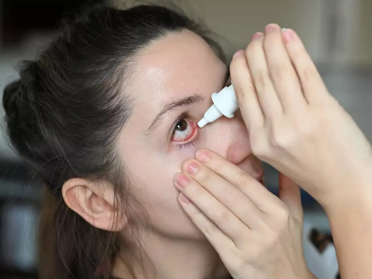 conjunctivitis.jpg