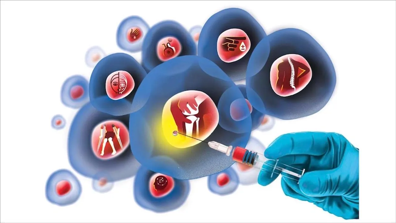 Stem Cell Therapy