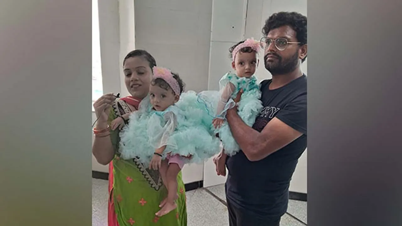 Conjoined Twins Ridhi Sidhi