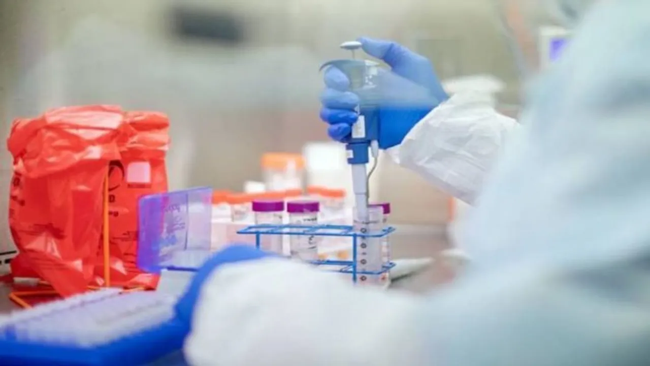 Novel test can identify patients at risk of severe COVID-19