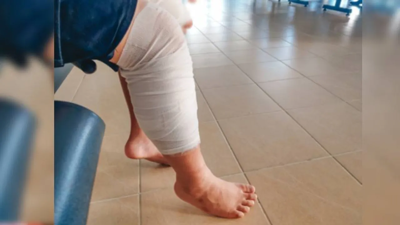 150KG ತೂಕದ ಗಂಡ ನನ್ನ ಮೇಲೆ ಕೂತು ಕಾಲು ಮುರಿದ! ಪತಿಯ ವಿರುದ್ಧ ಠಾಣೆ ಮೆಟ್ಟಿಲೇರಿದ ಪತ್ನಿ