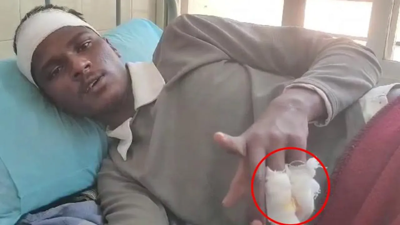 JDS​​ಗೆ ವೋಟ್ ಮಾಡಿದ್ದಕ್ಕೆ ಬೆರಳು ಕಟ್.. ಕಾಂಗ್ರೆಸ್​ ವಿರುದ್ಧ ಗಂಭೀರ ಆರೋಪ