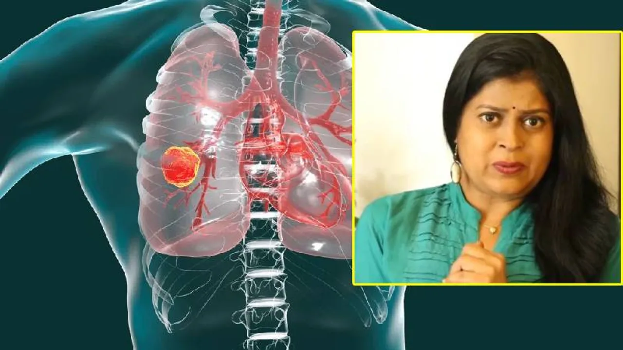 ಸಿಗರೇಟ್ ಸೇದದವರಿಗೆ ಲಂಗ್ ಕ್ಯಾನ್ಸರ್‌.. ಅಪರ್ಣಾ ಸಾವಿನ ಬೆನ್ನಲ್ಲೇ ಹೆಚ್ಚಿದ ಆತಂಕ; ಏನಿದು ಅಪಾಯ?