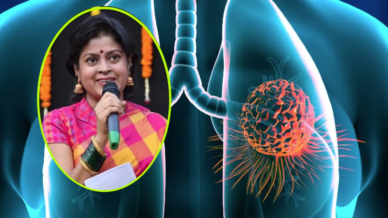 ಸಿಗರೇಟ್ ಸೇದದವರೇ ಎಚ್ಚರ.. ಹೆಚ್ಚಾಗ್ತಿದೆ ಅಪರ್ಣಾ ಬಲಿ ಪಡೆದ ಮಾರಕ ಕ್ಯಾನ್ಸರ್; ವೈದ್ಯರ ಸಲಹೆ ಏನು?