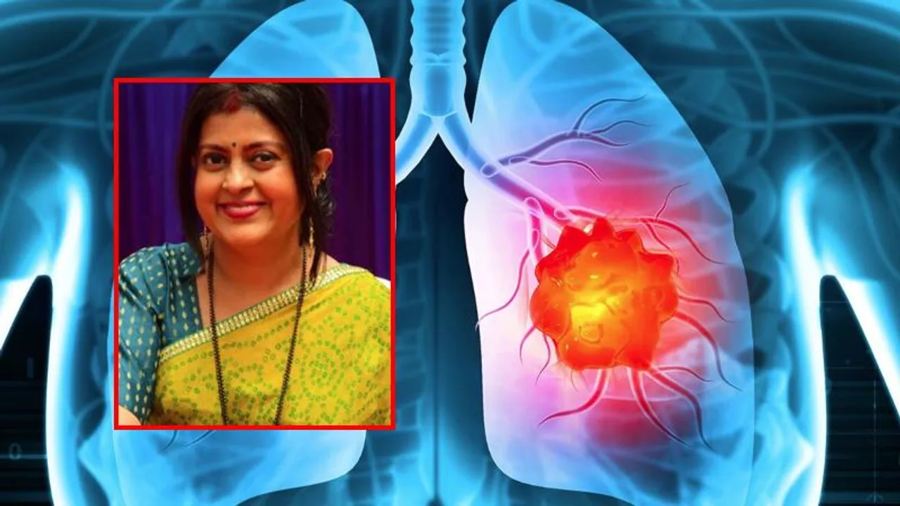 ಅಪರ್ಣಾ ಪ್ರಾಣ ತೆಗೆದ ಲಂಗ್‌ ಕ್ಯಾನ್ಸರ್‌ ಎಷ್ಟು ಭಯಾನಕ; ಈ ಚಿಕಿತ್ಸೆ ಬಗ್ಗೆ ವೈದ್ಯರು ಕೊಟ್ಟ ಸಲಹೆ ಏನು?