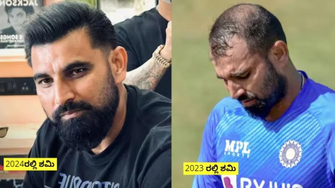 ಹೆಂಗಿದ್ದರು.. ಹೆಂಗಾದರು ನೋಡಿ.. ಶಮಿ ತಲೆ ಕೂದಲಿನ ರಹಸ್ಯ ಇಲ್ಲಿದೆ..!