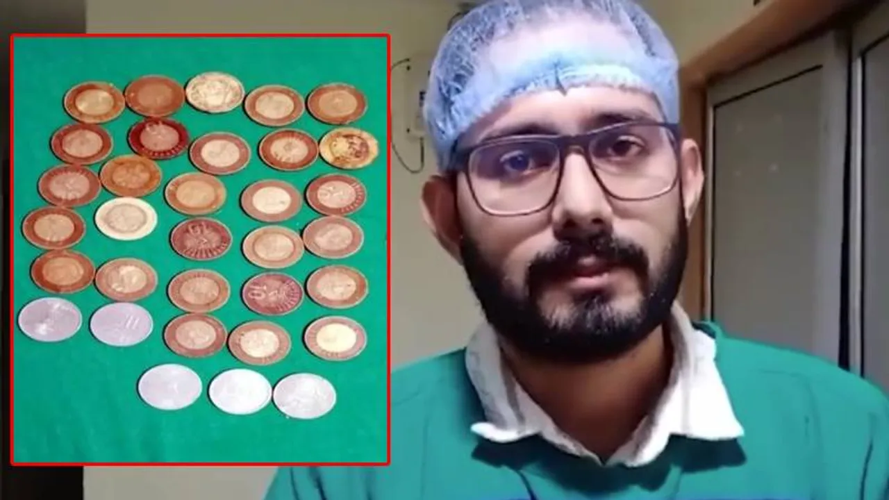 ₹2, ₹10, ₹20 ನಾಣ್ಯಗಳನ್ನೇ ನುಂಗಿ ಬದುಕಿದ್ದ ಭೂಪ; ಆಪರೇಷನ್ ಮಾಡಿದ ಡಾಕ್ಟರ್‌ಗೆ ಬಿಗ್ ಶಾಕ್‌!