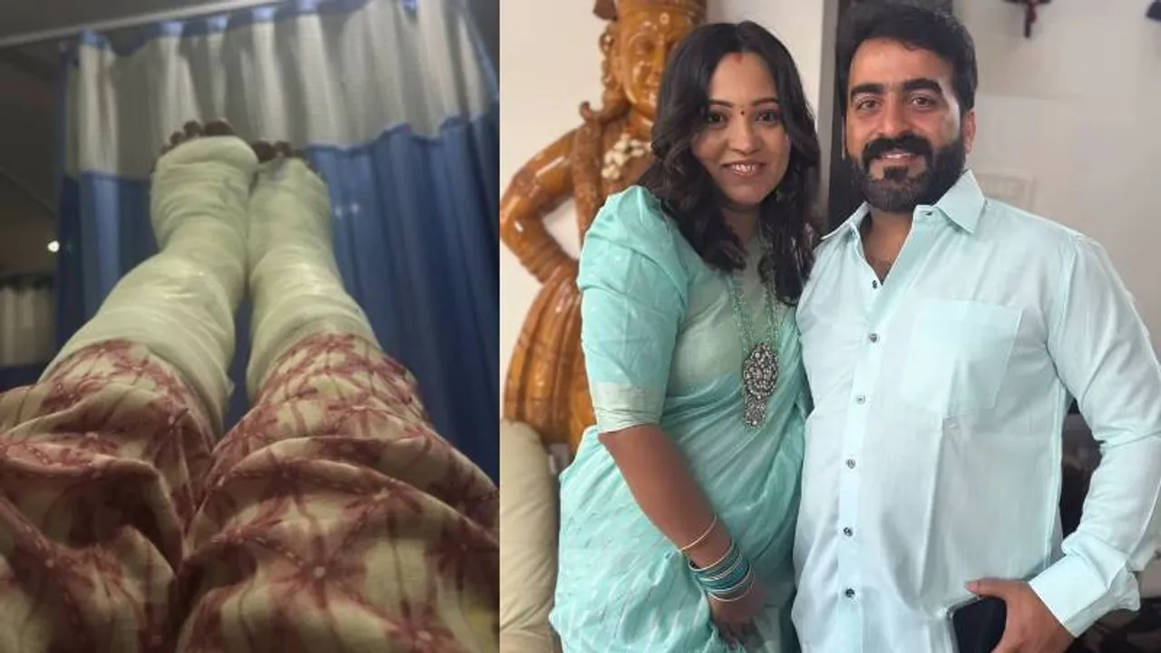 ನಿರೂಪಕ ಮಾಸ್ಟರ್ ಆನಂದ್ ಪತ್ನಿ ಯಶಸ್ವಿನಿ 2 ಕಾಲಿಗೆ ಬ್ಯಾಂಡೇಜ್.. ಅಸಲಿಗೆ ಆಗಿದ್ದೇನು?