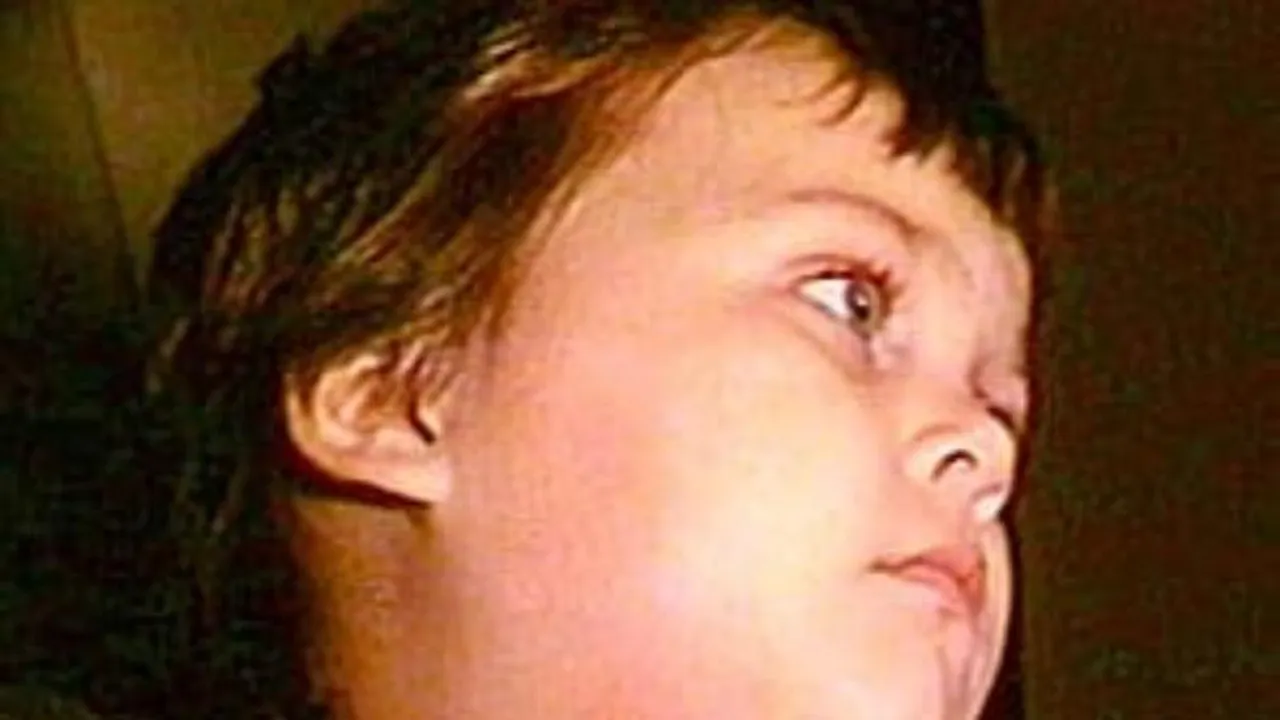 Surge in Mumps cases among children: experts unveil causes