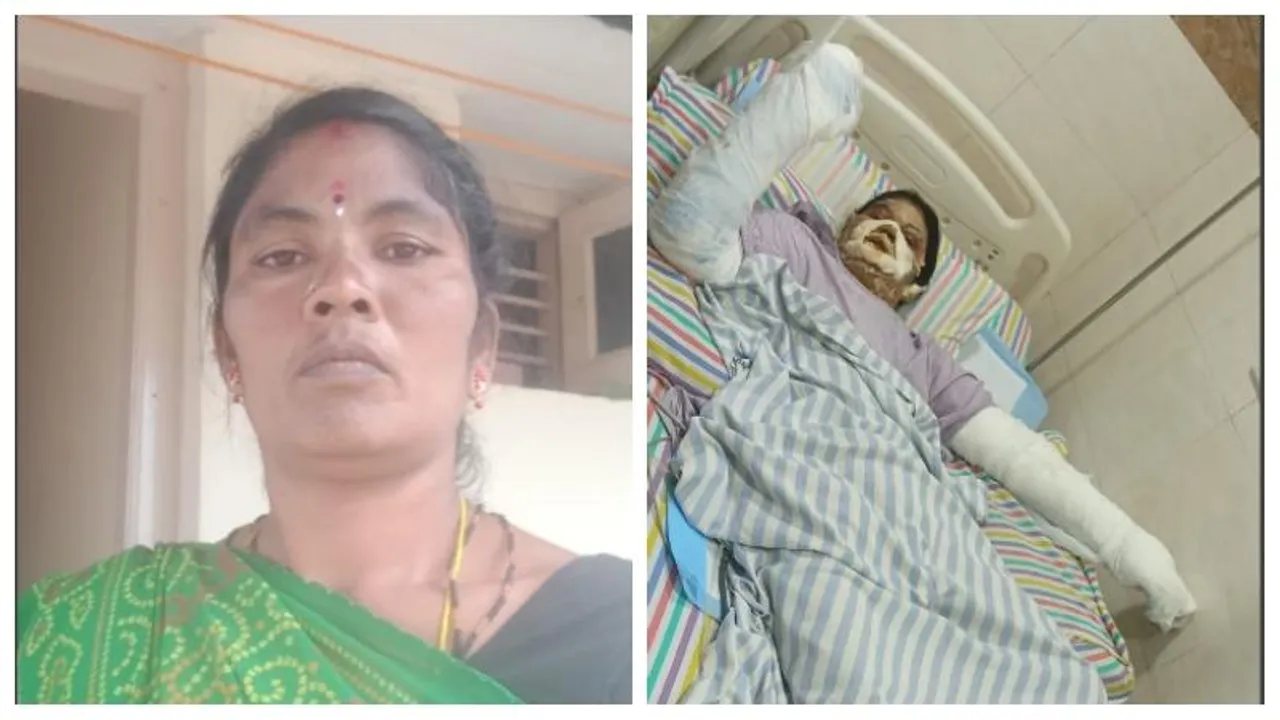 Geyser Explosion in Ullal: Woman Injured and Hospitalized