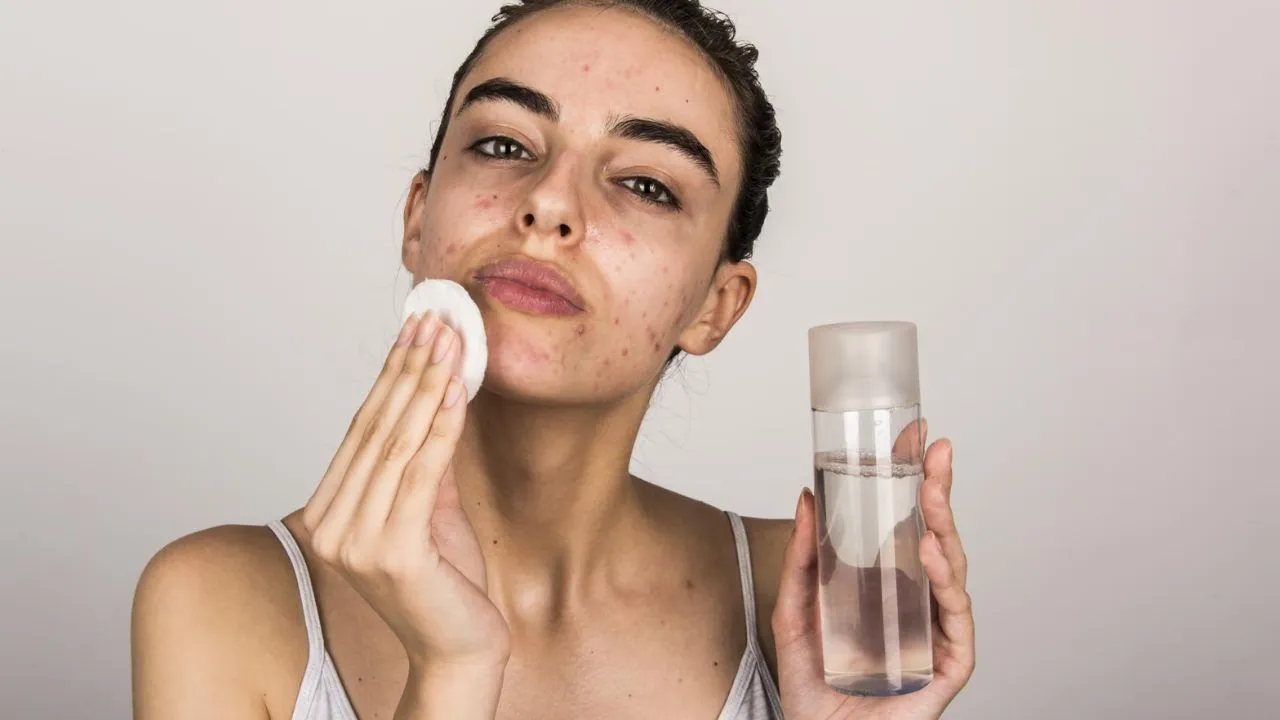 Best Skincare Products For Acne-Prone Skin