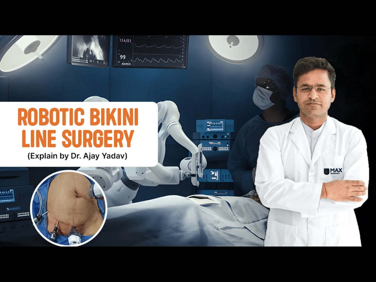 Robotic Bikini Line Surgery: A Modern Approach to Gallbladder Removal