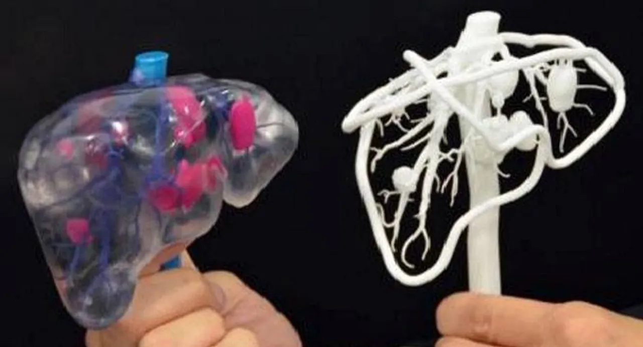 Low cost 3D human organ models in the offing