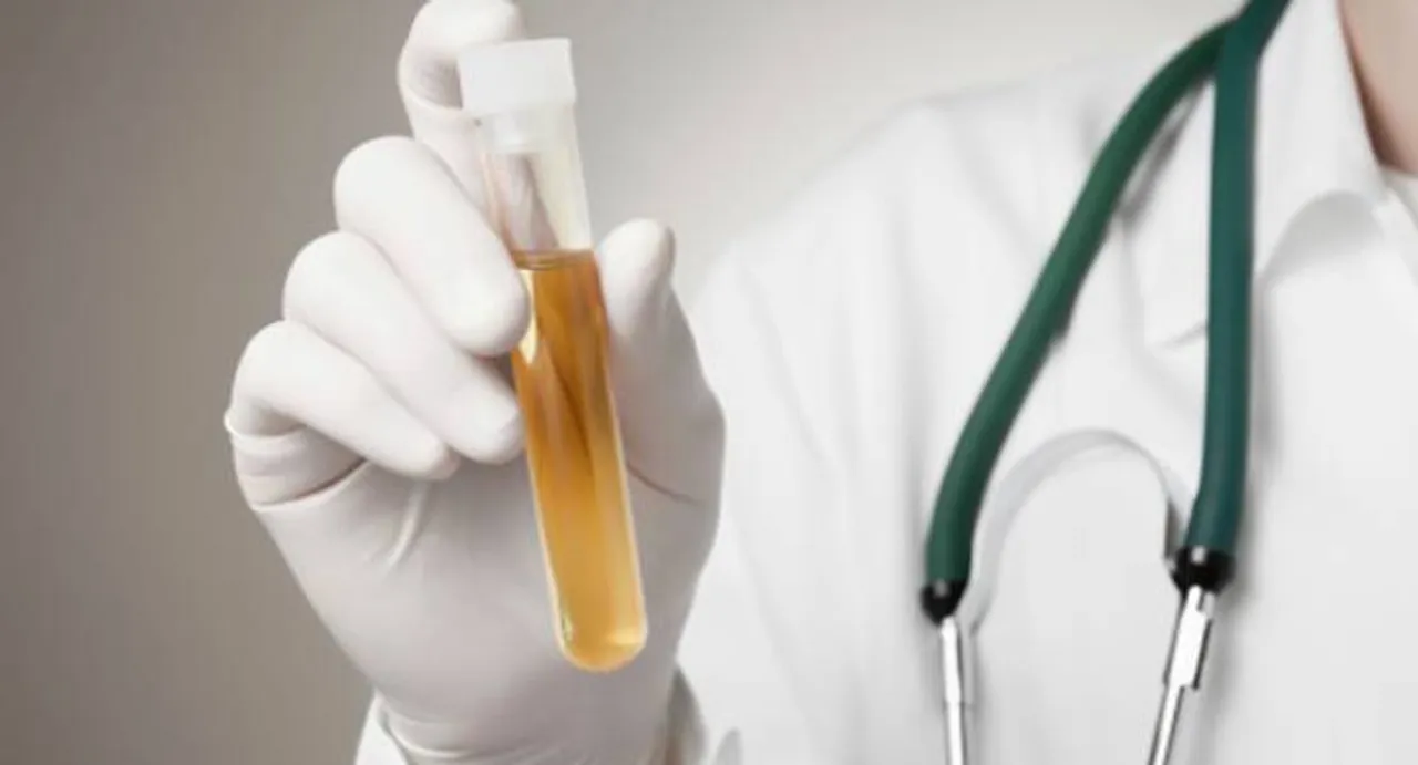 Urine odour may help detect Alzheimer's early
