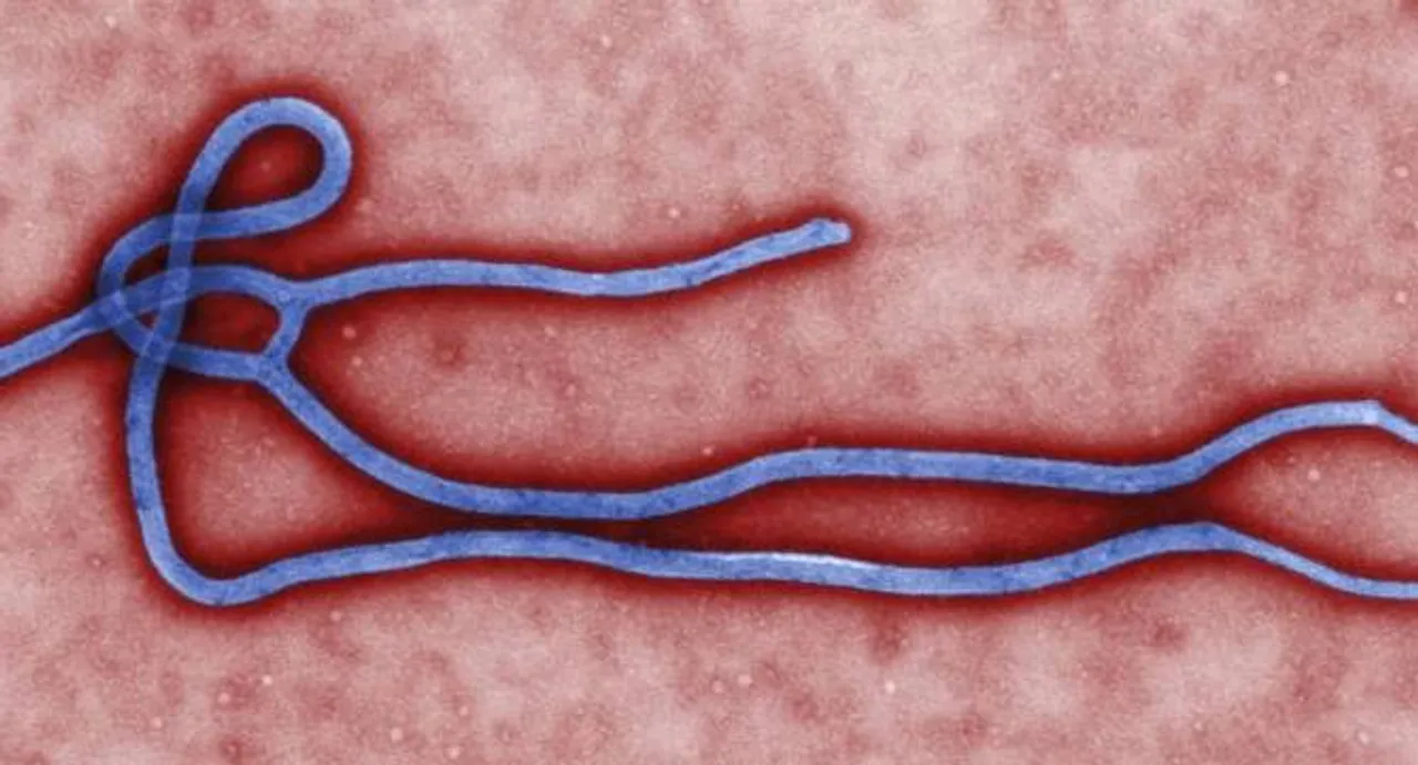 Human antibodies may provide 'silver bullet' against Ebola