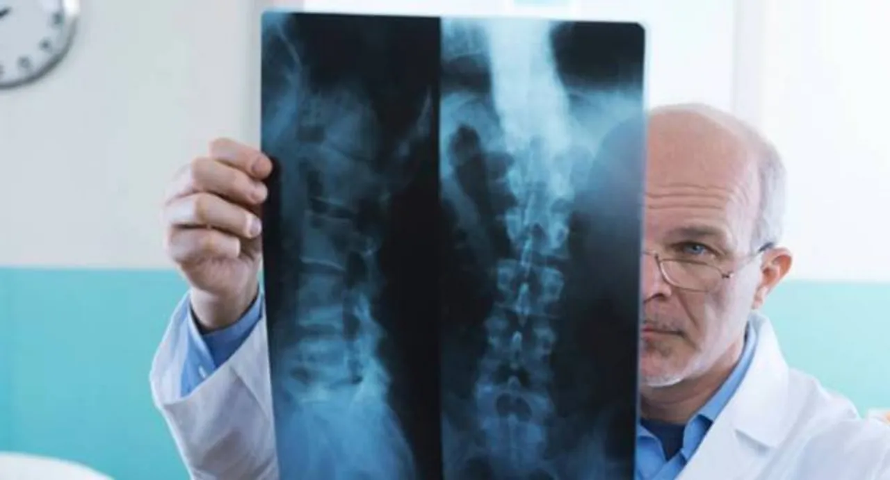 No proof of X-rays, CT scans radiation causing cancer: study