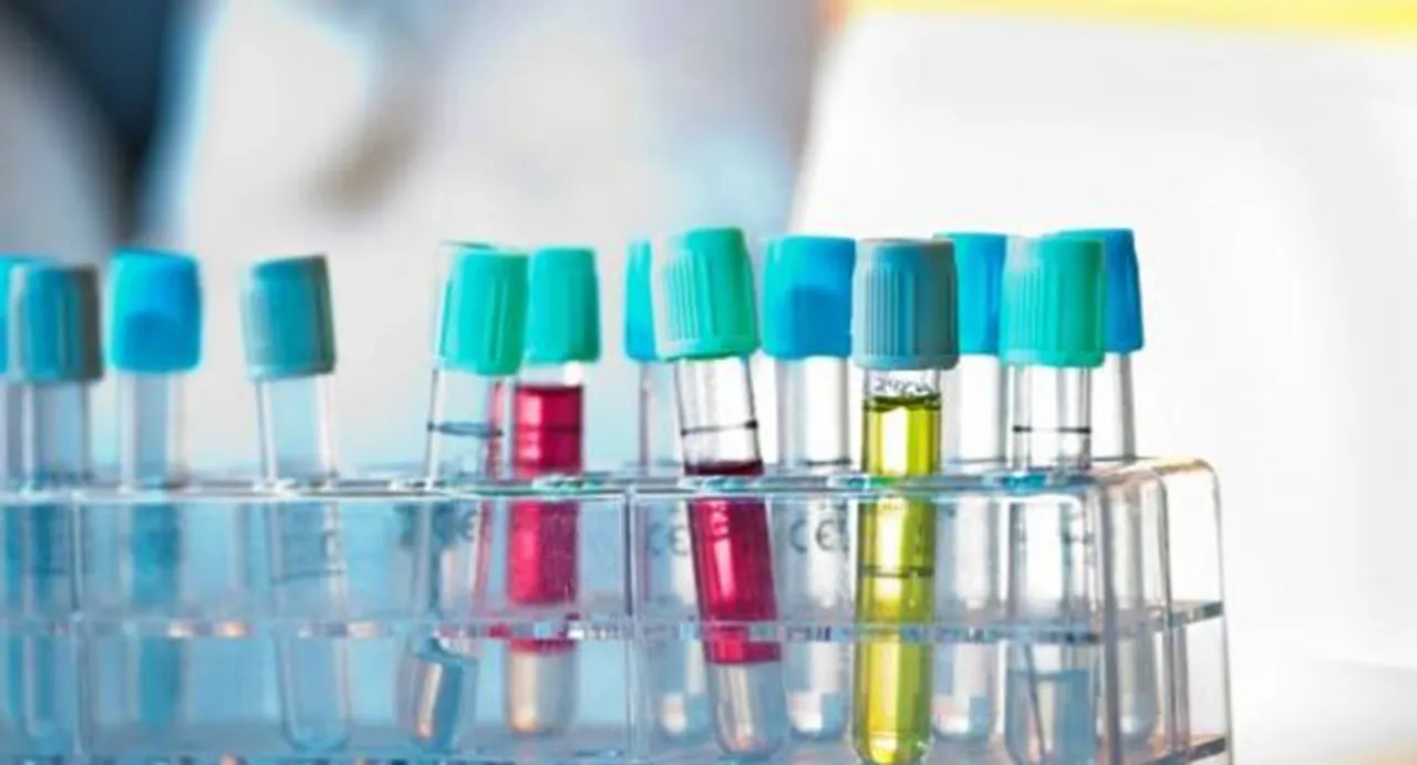 Routine blood test may detect Alzheimer's: study