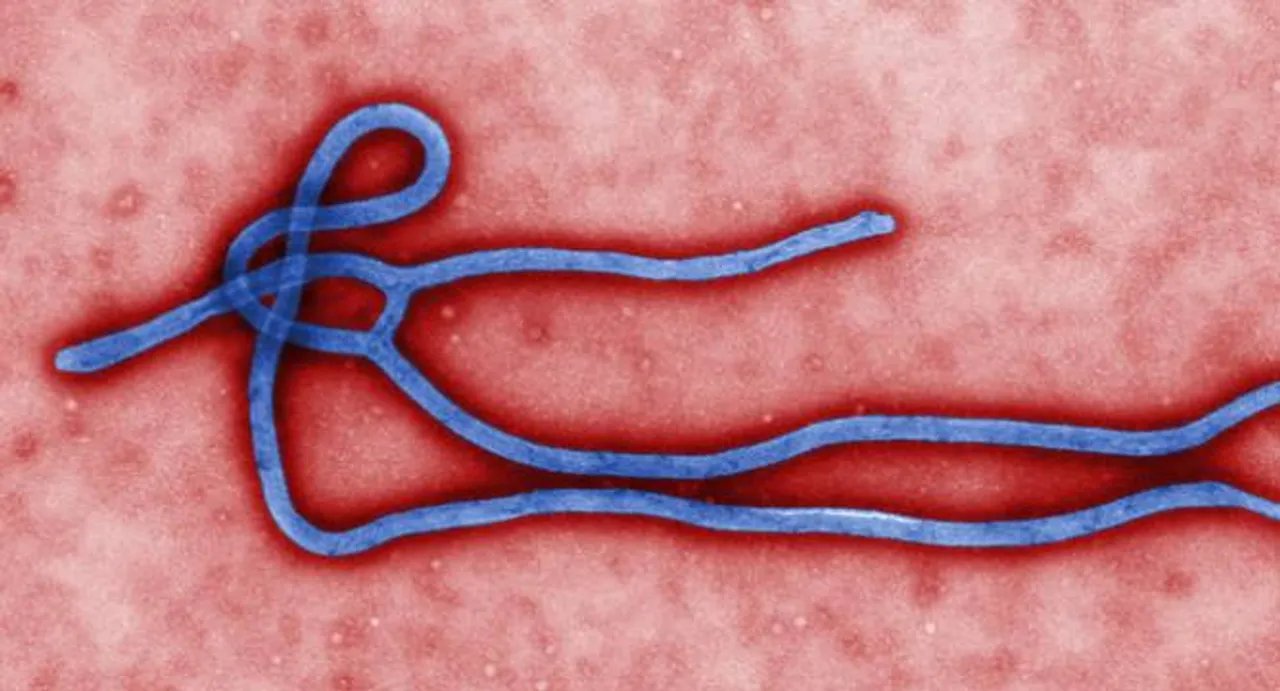 Ebola nurse admitted to UK hospital for third time