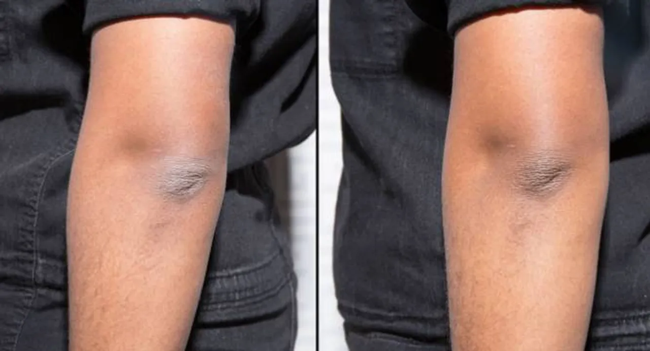 How to avoid ashy skin?