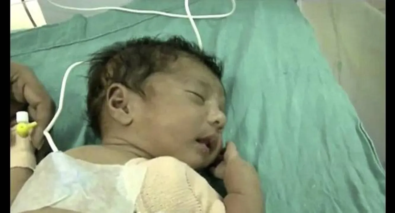 Rare surgery on 2-month-old baby who suffered heart attacks