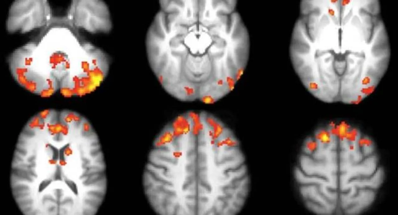 Video games may improve brain function in MS patients: study