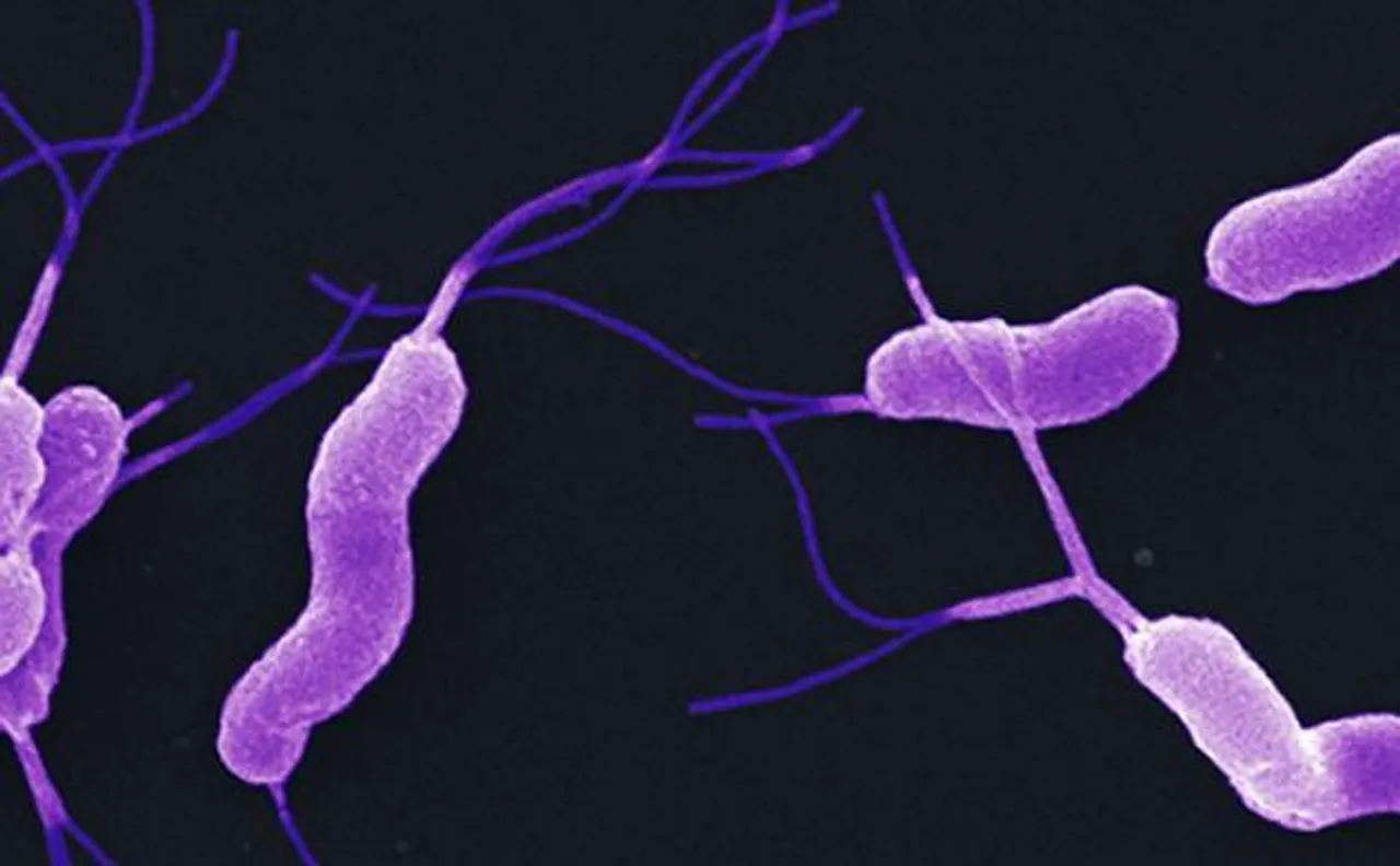 Intestinal bacteria may help prevent cancer: study
