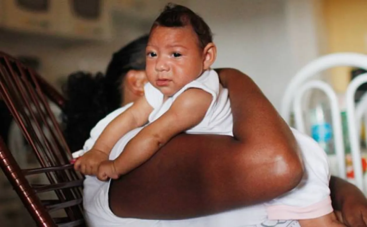 Brazil has over 91000 registered cases of Zika virus outbreak