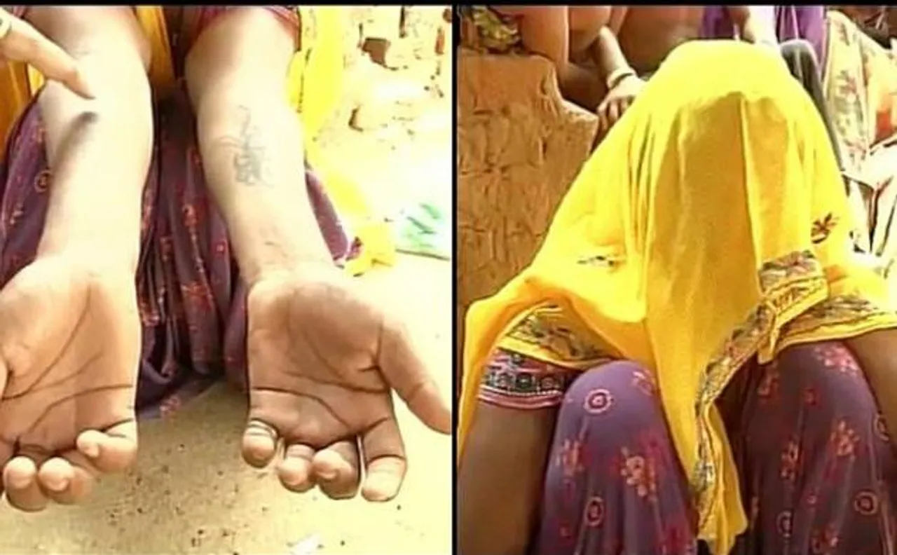 My father is a thief: In-laws rape, tattoo woman's body with abuses in Rajasthan