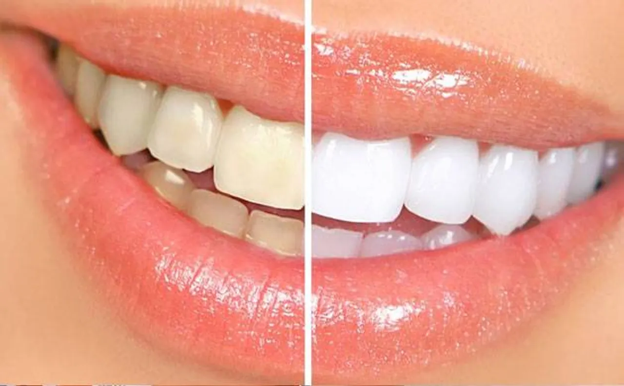 Video selfies â€“ a new way to improve oral health