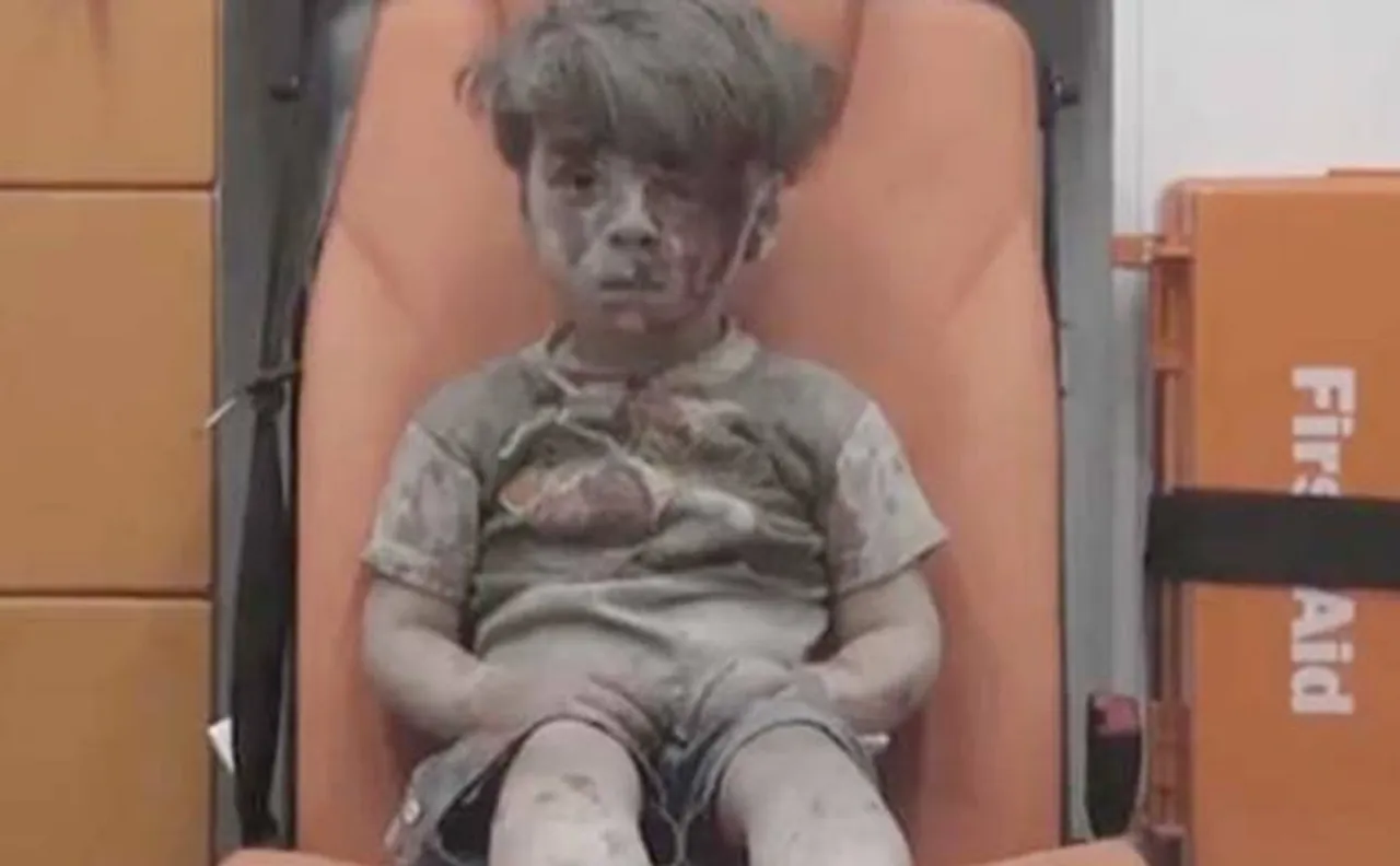Syria conflict: Picture of bloodied face of a child in Aleppo draws outrage and shock