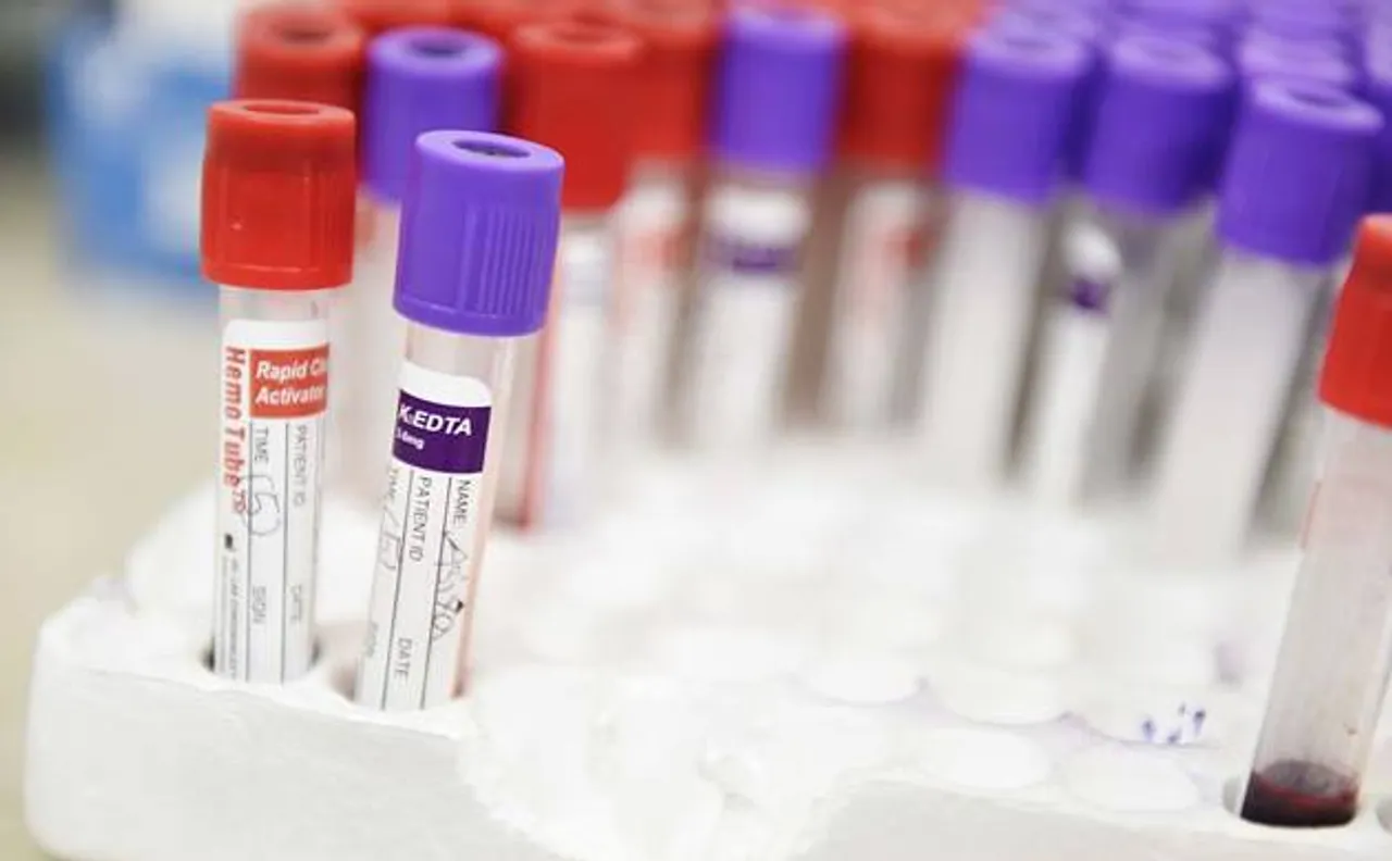 Chikungunya outbreak: Delhi toll climbs to 11, Union Health Ministry seeks report from state govt