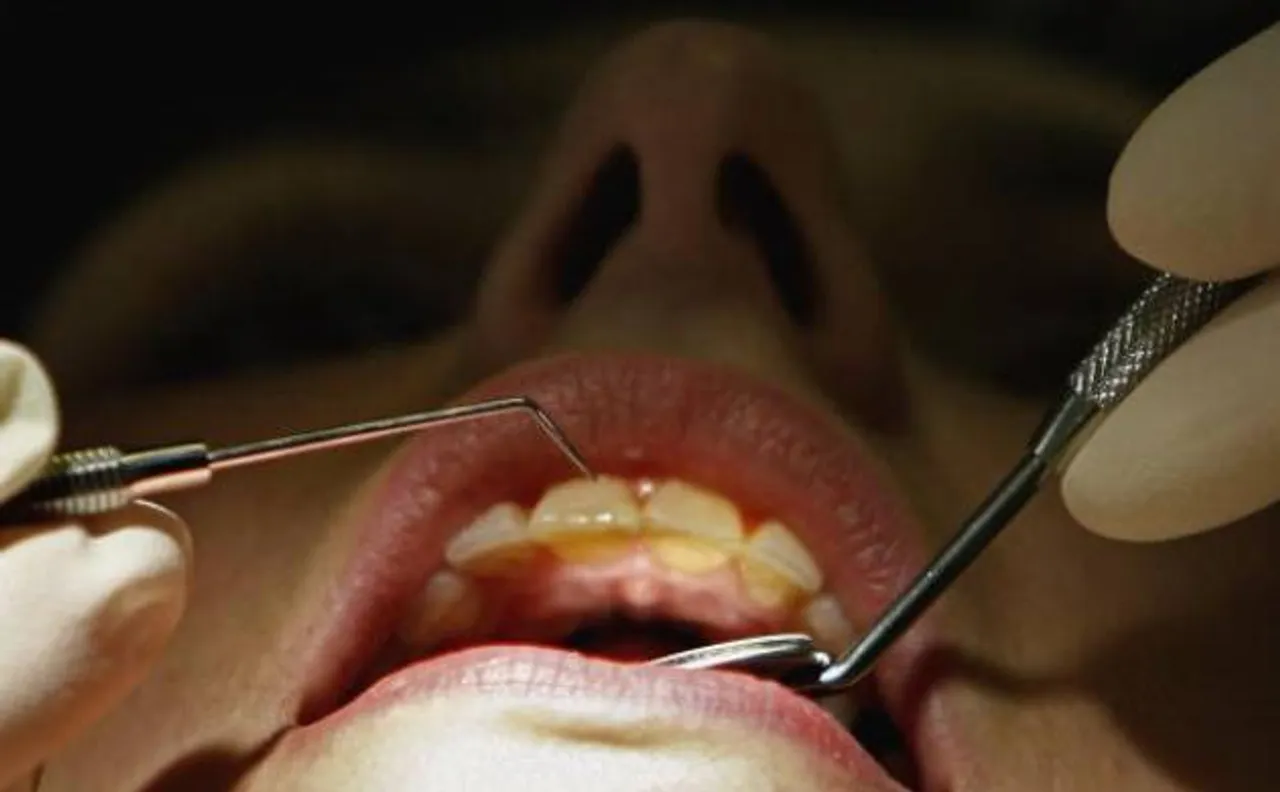  People with eight dental fillings may have 150 per cent more mercury in their blood: Study