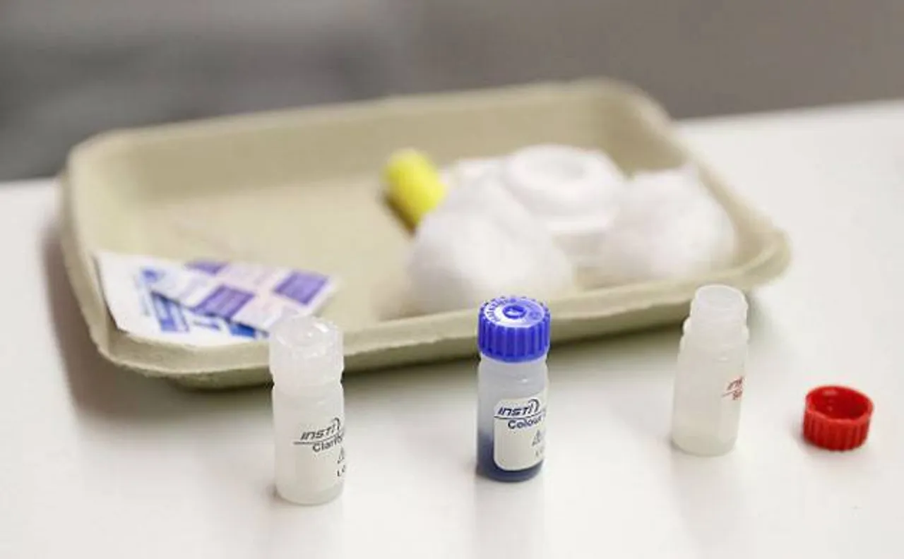 HIV patients diagnosed at advanced stages are more likely to transmit the infection: Research