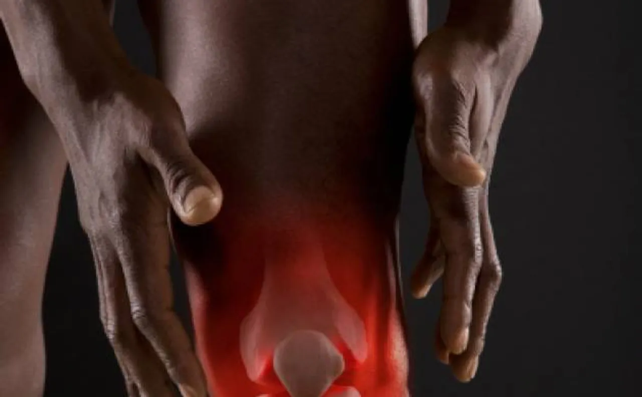 Keep high cholesterol diet at bay to prevent osteoarthritis   