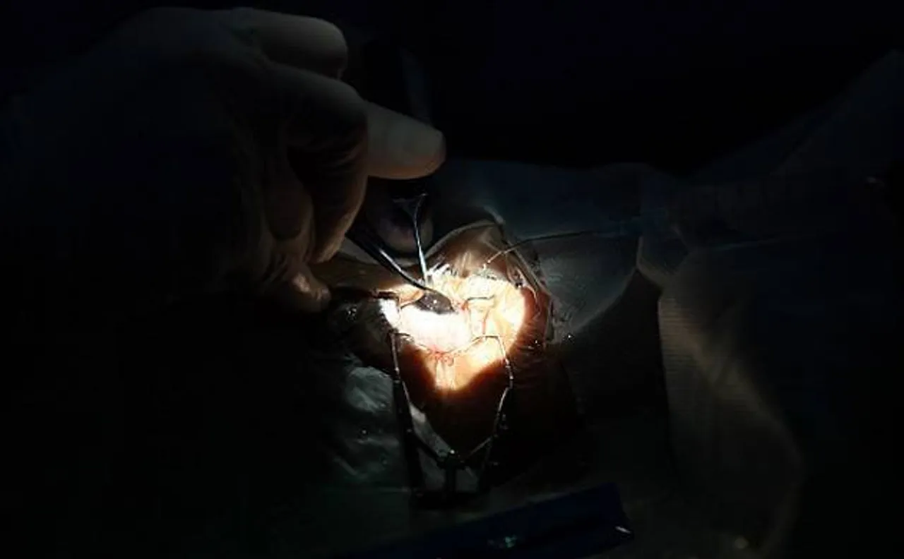 Scientist discover more fragmented and complex organ identified in human body